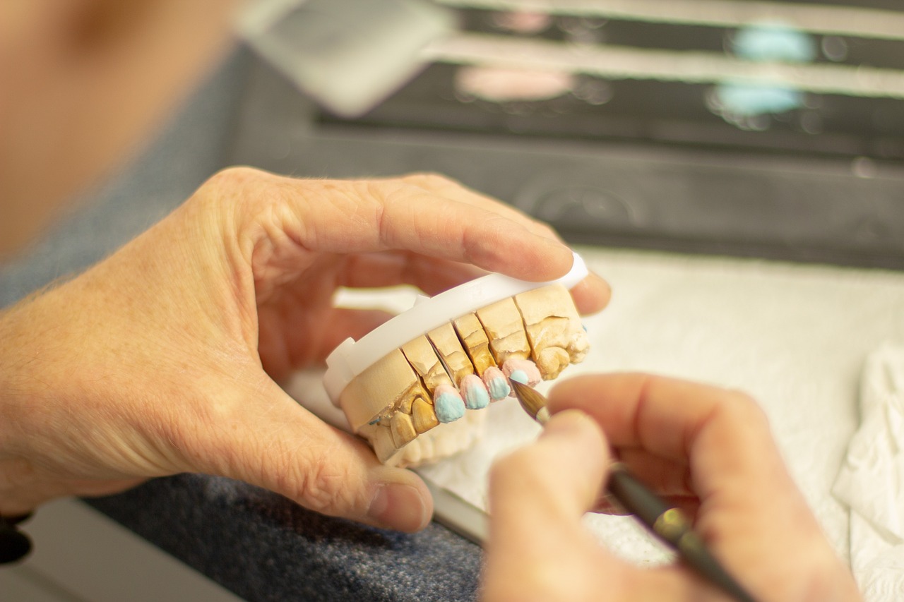 Full-arch dental implant prosthetics representing the high value of implant treatment